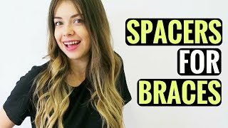 GETTING SPACERS FOR BRACES  WHAT ARE SPACERS PAIN HOW LONG [upl. by Aicinoid]