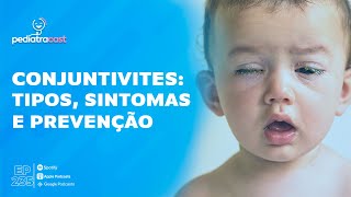 CONJUNTIVITES TIPOS SINTOMAS E PREVENÇÃO [upl. by Ark]