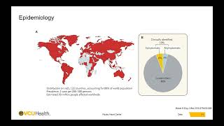 DOIM GR 101923 Hypertrophic Cardiomyopathy [upl. by Ferree]