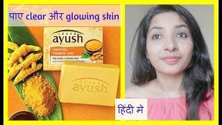 lever ayush PURIFYING TURMERIC SOAP for clear amp glowing skin REVIEW IN hindi [upl. by Ahsian]