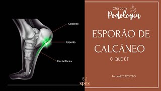 EP6 Chá com Podologia ESPORÃO DE CALCÂNEO  Janete Azevedo [upl. by Lontson676]