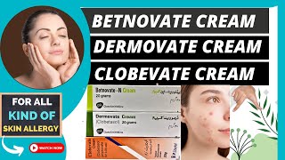 Betnovate Clobevate and Dermovate Creams Which One is Right for Hands foot and skin allergy [upl. by Anaul]