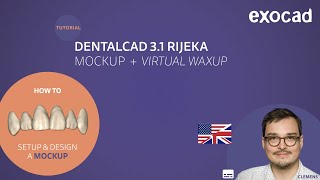 Mockup amp Virtual Waxup VIDEO TUTORIAL [upl. by Bowrah]