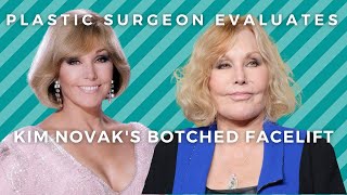 Kim Novaks Botched Facelift Plastic Surgeon Reacts [upl. by Ajani]