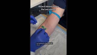 Blood specimen collection  Human biology anatomy youtube science [upl. by Vernen]