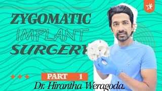 Zygomatic Implant Surgery PART 1 [upl. by Bilbe739]