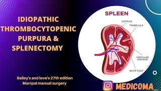 IDIOPATHIC THROMBOCYTOPENIC PURPURA  Etiology Types Clinical Features investigation Treatment [upl. by Ellenwahs]