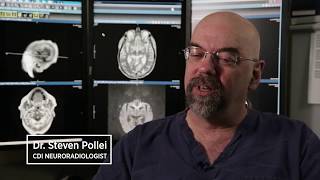 How MRI Can Help Diagnose and Track Multiple Sclerosis [upl. by Kerwinn]