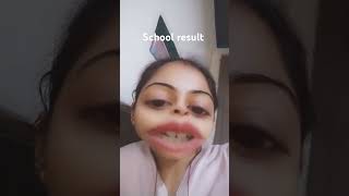 School ka result comedy trending funny [upl. by Dranek]