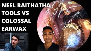 The Neel Raithatha Tools VS Colossal Earwax Blockage First Impressions [upl. by Lishe]