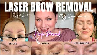 MY MICROBLADING LASER REMOVAL EXPERIENCE I HAD PINK BROWS BUT WAS IT ALL WORTH IT [upl. by Weidner]