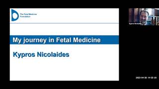 Prof Kypros Nicolaides Fetal Medicine [upl. by Mourant]