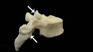 6 Revisión de huesos articulaciones y ligamentos de la columna vertebral [upl. by Nonnah]