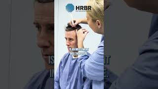 Anton Du Beke at Hair Restoration Blackrock Teaser Short [upl. by Recha]