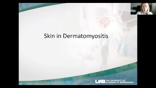 Myositis and the Skin [upl. by Pollard274]