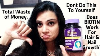 Biotin Review Before and After  My Honest Review of 3 Months  Madams Choice [upl. by Earized]