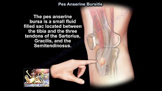 Pes Anserine Bursitis  Everything You Need To Know  Dr Nabil Ebraheim [upl. by Dacie]