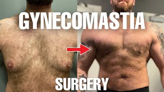 Gynecomastia Surgery changed my LIFE [upl. by Ahcsrop]