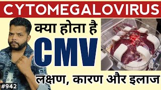 CMV Infection क्या होता है  Cytomegalovirus Explained In Hindi [upl. by Ayekel53]