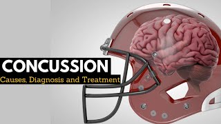 CONCUSSION Causes Signs and Symptoms Diagnosis and Treatment [upl. by Willyt]