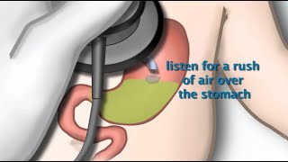 Nasogastric Tube Placement by S Hamilton  OPENPediatrics [upl. by Aedni]