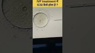 ICSI Procedure in IVF Intracytoplasmic sperm injection fertilitytreatment ivfjourney ivfsuccess [upl. by Faunia]