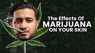 The Shocking Effects Of MARIJUANA On Your Skin [upl. by Elsey]