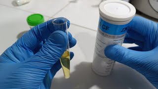 laboratory process for urine analysis [upl. by Eittol252]