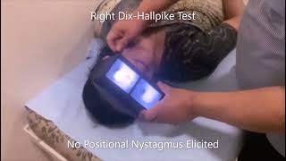 Augmented Right Half Hallpike Test [upl. by Brigham]