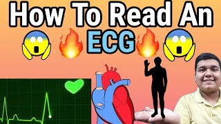 How to Read an ECG  ECG reading explained [upl. by Freud]