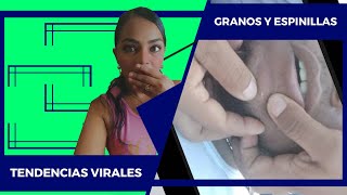 Puntos negrisimos 2022  Videos satisfactorios  tendencias 2022 [upl. by Yona]