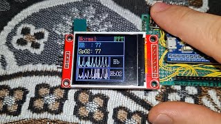 STM32 HEART RATE MONITOR MAX30100 STM32F103 ST7735 [upl. by Trillbee]