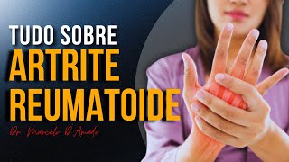 ARTRITE REUMATOIDE SINTOMAS E TRATAMENTOS QUE VOCÊ PRECISA CONHECER [upl. by Tabitha721]