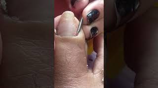 pedicuremedicure how to remove dry skin amp cuticle [upl. by Rednael46]