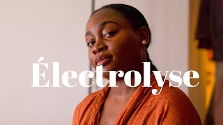 ELECTROLYSE  Epilation définitive  Deux ans après en suis je satisfaite [upl. by Truc]