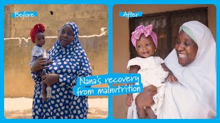 Nana’s recovery from severe malnutrition in Nigeria  UNICEF [upl. by Ignacio]