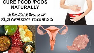 PCOD problem solution in kannadaPCOD Diet Plan in KannadaSimple tips for PCODMy PCOD storyPCOS [upl. by Alekim254]