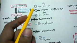 Tyrosine metabolism and genetic disorders accosiated with it [upl. by Ddart]