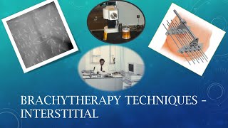 Brachytherapy Lecture No 2 Interstitial Brachytherapy [upl. by Corella90]