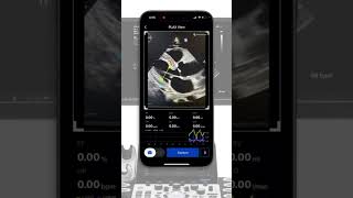 mobile Echocardiography AI solution [upl. by Hanforrd]