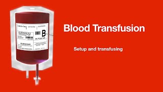 Blood transfusion Setup and transfusion [upl. by Morganica]