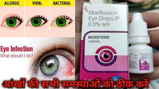 Moxiford Eye Drop Review  Moxifloxacin  Uses and Benefits  And How To Use  In Hindi [upl. by Birdella]