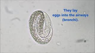 Dictyocaulus viviparus egg Bovine Lungworm quotHoosequot [upl. by Sidhu]