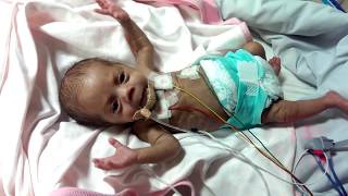 How a preemie baby started crying when she was Hungry [upl. by Deny]