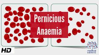 Pernicious Anemia Causes Signs and Symptoms Diagnosis and Treatment [upl. by Millburn]