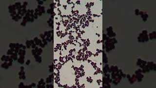 Gram Staining Insights Identifying Staphylococcus hominis as GPC in Singles Pairs and Clusters [upl. by Edith]