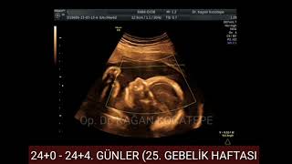 24 HAFTALIK 55 AYLIK GEBELÄ°KTE KIZ BEBEK NASIL GÃ–RÃœNÃœRRENKLÄ° DOPPLER4 BOYUTLUDETAYLI ULTRASON [upl. by Pastelki]