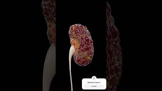 POLYCYSTIC KIDNEY DISEASE…shortsvideo viralvideo nursesnotes humanbodysystem [upl. by Haraj]