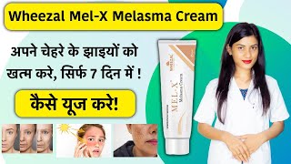 Wheezal MelX Cream Uses in Hindi  Wheezal MelX Cream Review  Mel X Cream  Mel X Melasma Cream [upl. by Girvin]