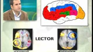 Dislexia 2ª parte entrevista en Etb2 [upl. by Ardekan]
